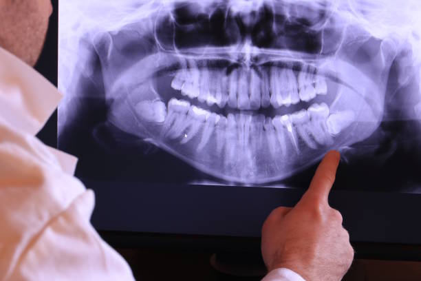 Best Emergency Treatment for Toothache in Chama, NM